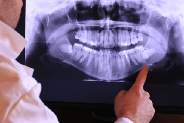 Best Cracked Tooth Emergency Dentist  in Eatonville, FL